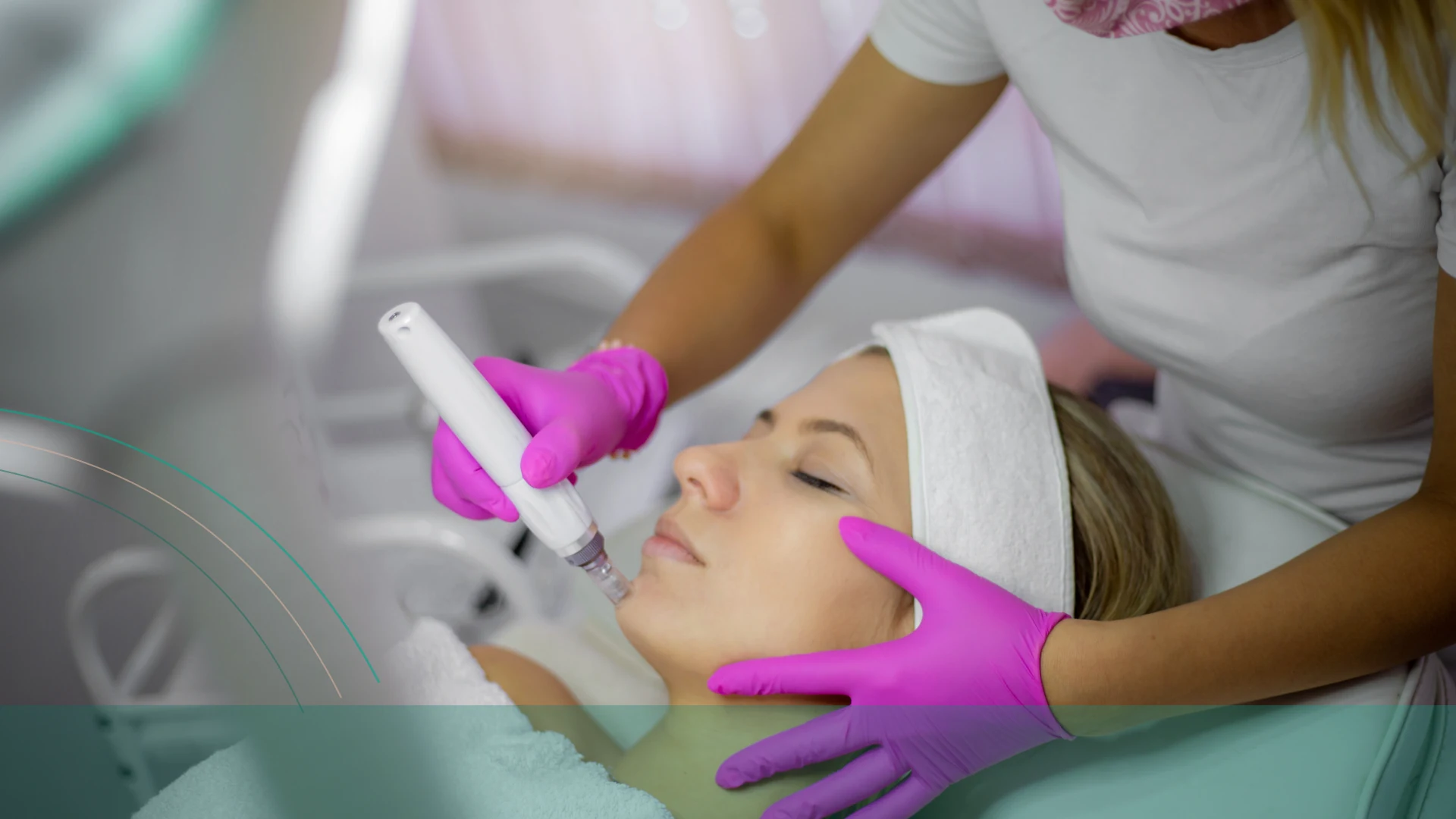 Dermapen frente lineas expresion