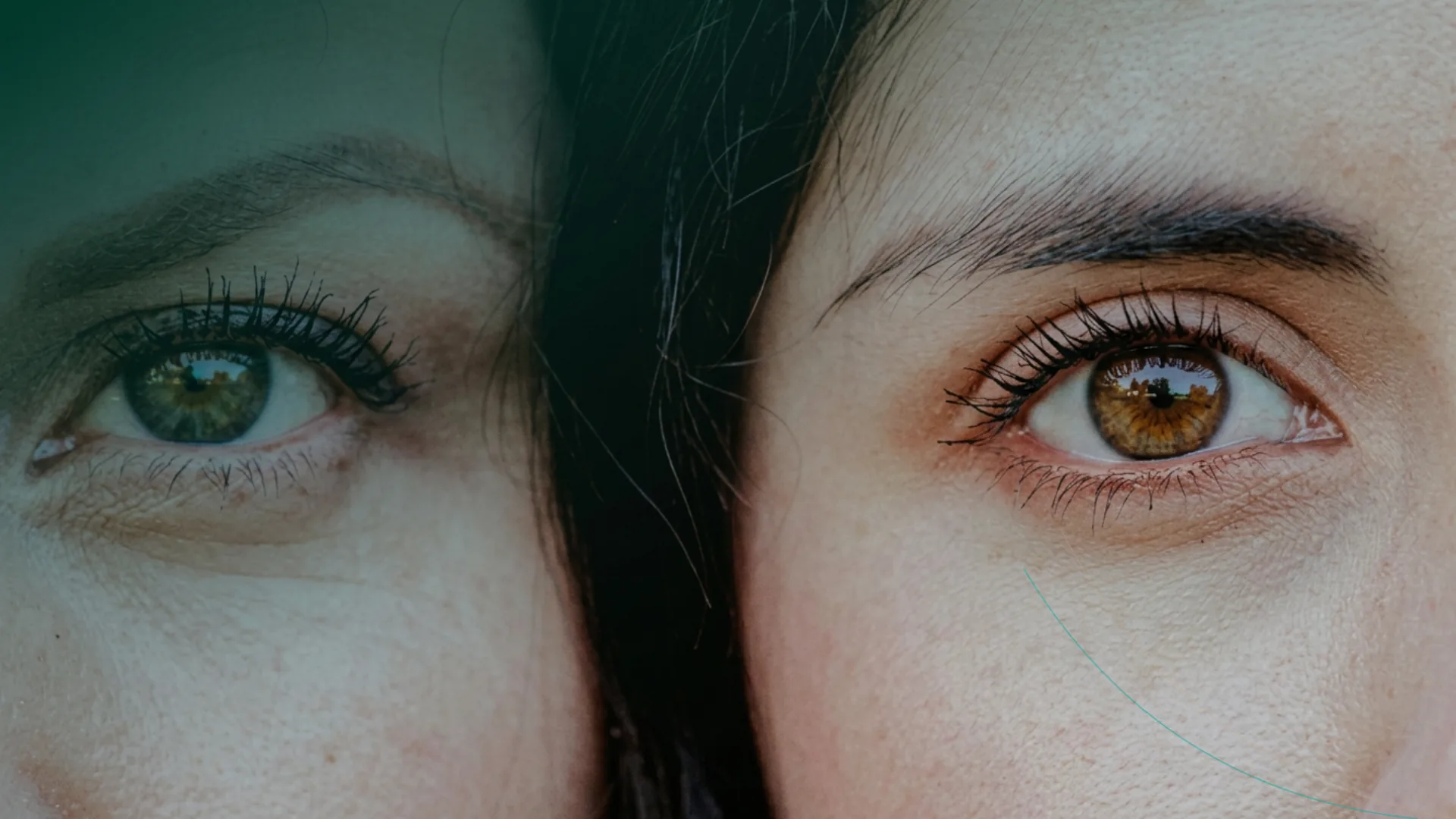 Dermapen ojeras contorno ojos