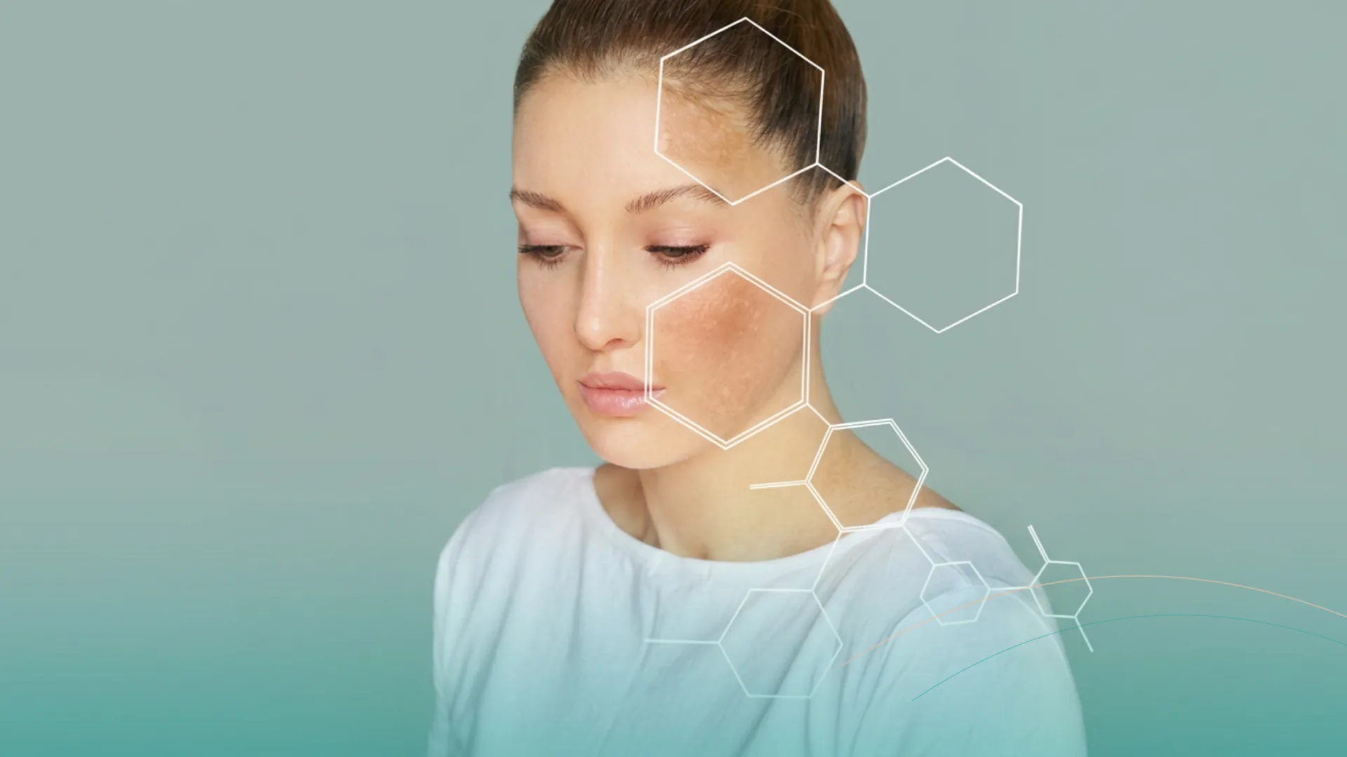 Microneedling analisis facial digital