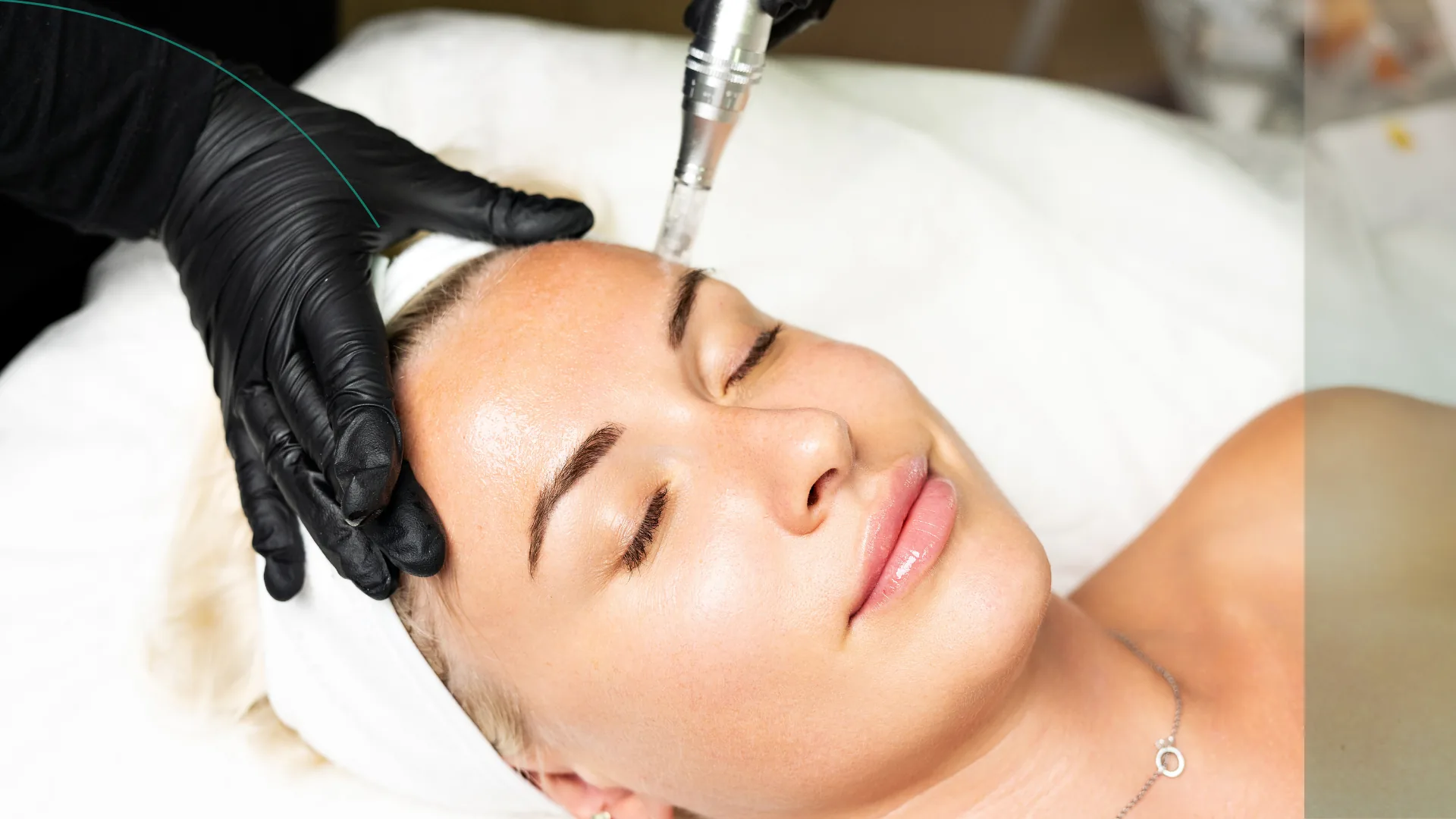 Microneedling hombre rejuvenecimiento facial