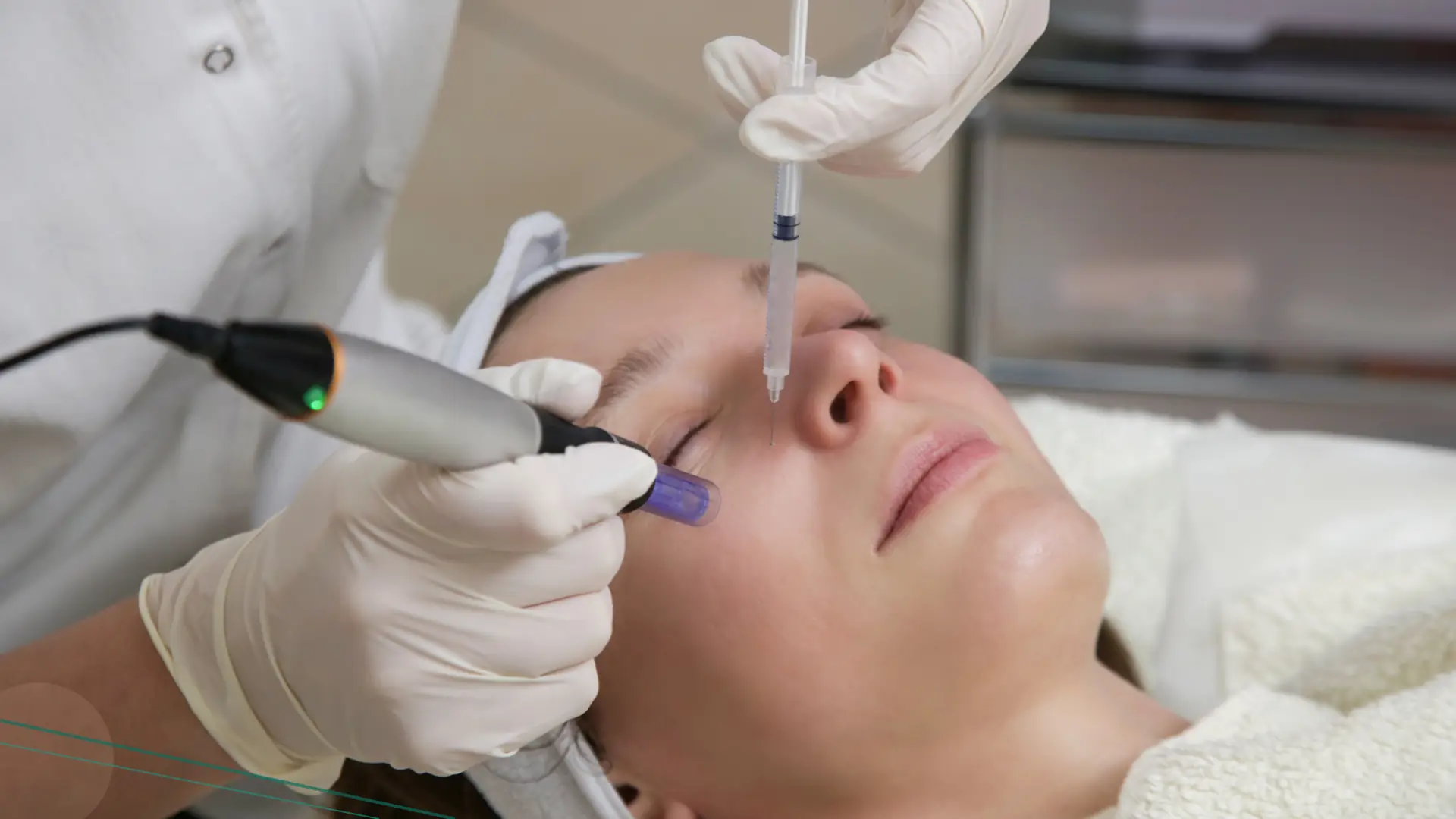 Microneedling vitaminas facial