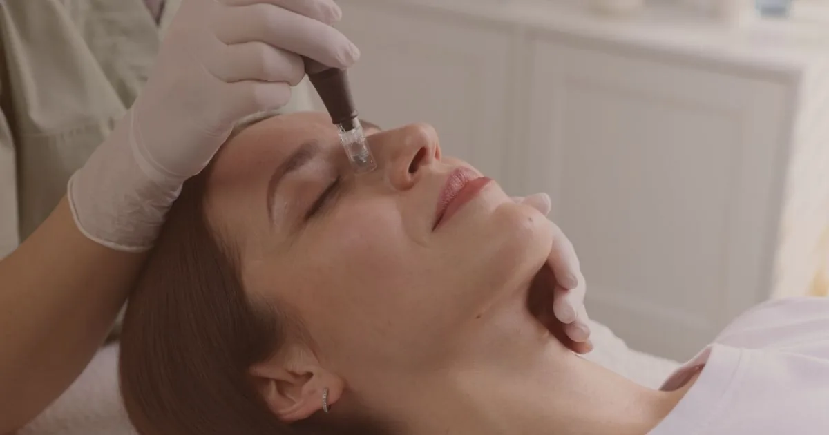 Diferenciar un Tratamiento Profesional de Microneedling es Clave en un Mercado Saturado
