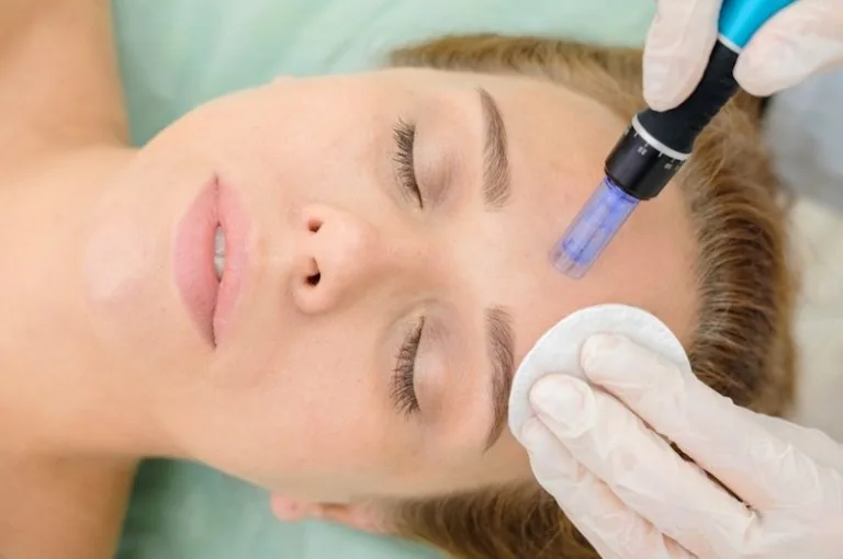 Microneedling Profesional vs. Otros Tratamientos Faciales: ¿Cuál es la Mejor Opción para tu Piel?