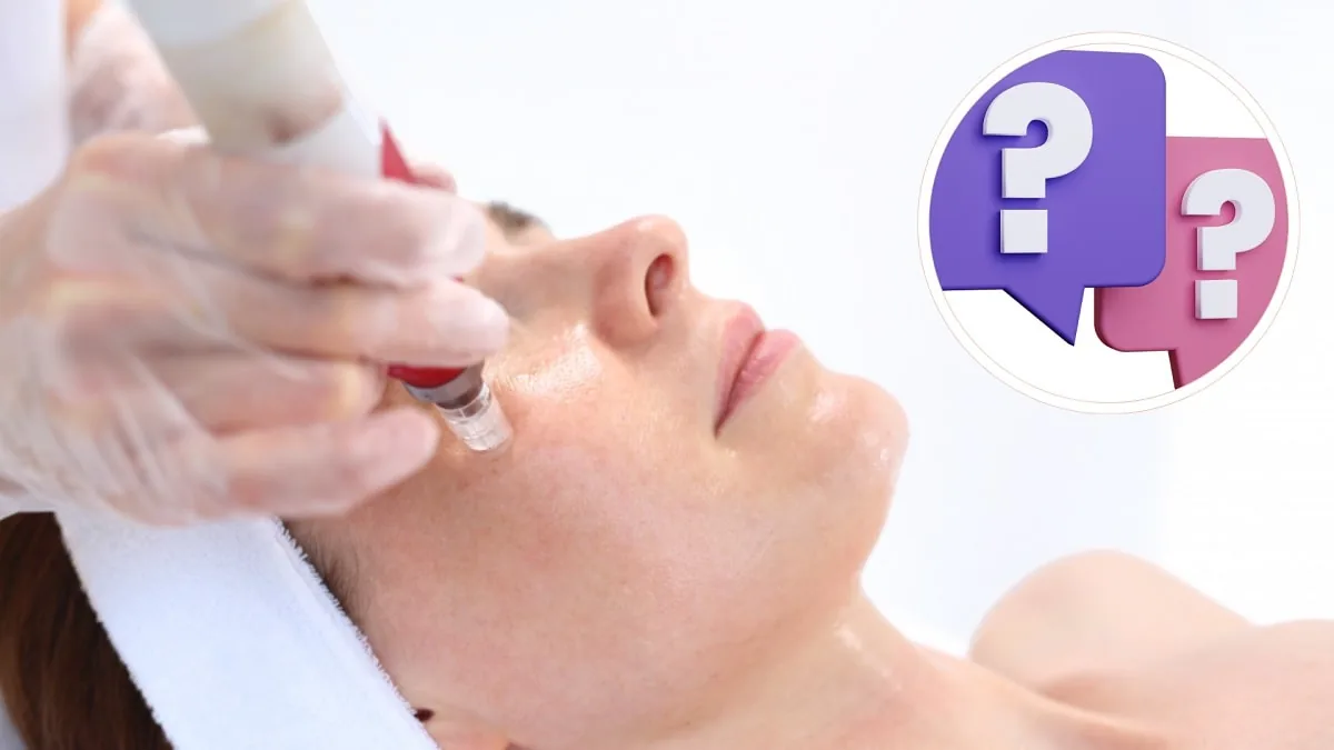 Microneedling: 18 Preguntas Frecuentes Antes de Hacerte el Tratamiento [+Respuestas 2025]