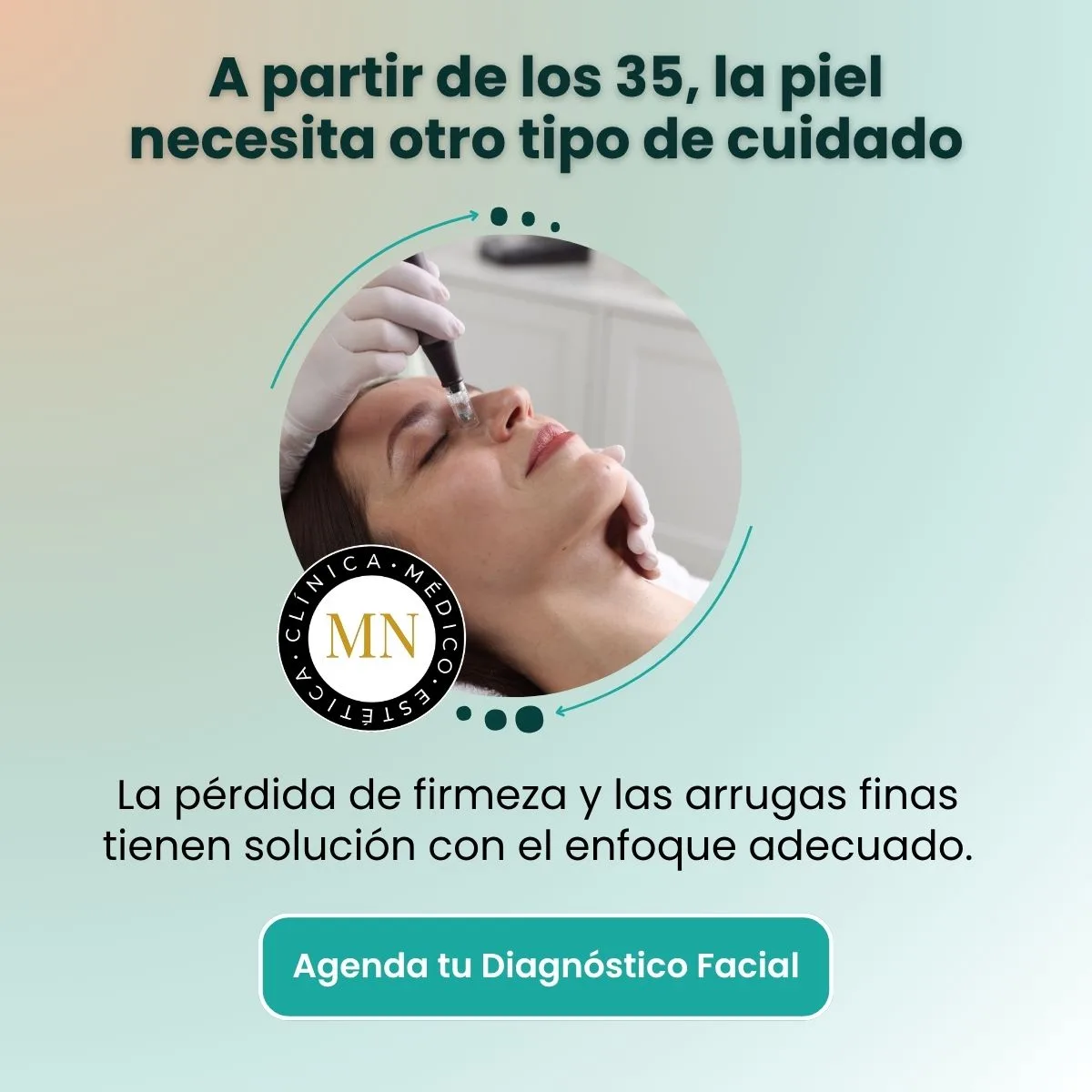 Antes y después de microneedling en Clínica Médico Estética Mayka Navarro