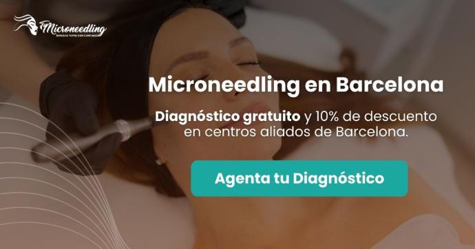 Centro de estética profesional especializado en microneedling en Barcelona