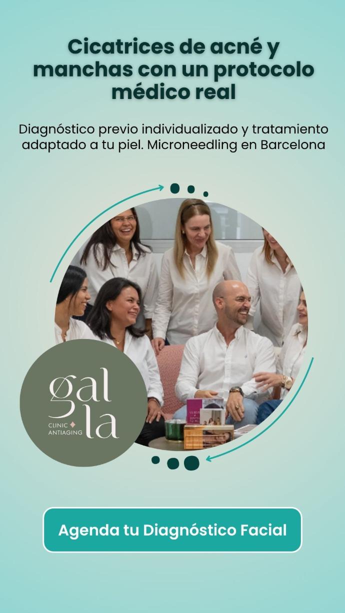 Tratamiento microneedling en Gal.la Clinic Barcelona Microneedling médico para cicatrices de acné y manchas en Gal.la Clinic Barcelona